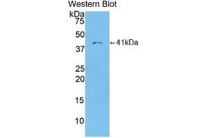 Detection of recombinant MDC using Polyclonal Antibody to Macrophage Derived Chemokine (MDC) (CCL22 antibody  (AA 25-93))