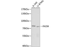 Western blot analysis of extracts of various cell lines, using P antibody (ABIN7269207) at 1:1000 dilution. (PAD4 antibody  (AA 374-550))