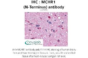 Image no. 1 for anti-Melanin-Concentrating Hormone Receptor 1 (MCHR1) (Extracellular Domain), (N-Term) antibody (ABIN1736819) (MCHR1 antibody  (Extracellular Domain, N-Term))