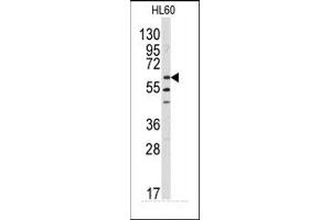 Image no. 1 for anti-V-Yes-1 Yamaguchi Sarcoma Viral Related Oncogene Homolog (LYN) (N-Term) antibody (ABIN359987)