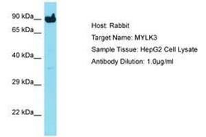 Image no. 1 for anti-Myosin Light Chain Kinase 3 (MYLK3) (C-Term) antibody (ABIN6750729) (MYLK3 antibody  (C-Term))