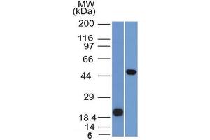 Western Blot Analysis (A) Recombinant Protein(B) Raji cell lysate UsingPAX8 Mouse Monoclonal Antibody (PAX8/1491). (PAX8 antibody  (AA 60-261))