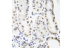 Immunohistochemistry of paraffin-embedded human stomach using SFPQ antibody. (SFPQ antibody)