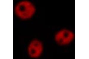 ABIN6266815 staining 293 by IF/ICC. (THRB antibody  (Internal Region))