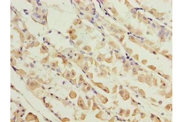 KIF26B antibody  (AA 8-133)