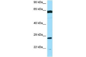 WB Suggested Anti-PMM2 AntibodyTitration: 1. (PMM2 antibody  (Middle Region))