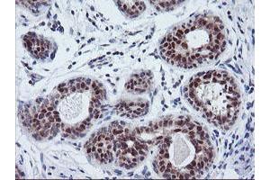 Immunohistochemical staining of paraffin-embedded Human breast tissue using anti-TIMP2 mouse monoclonal antibody.