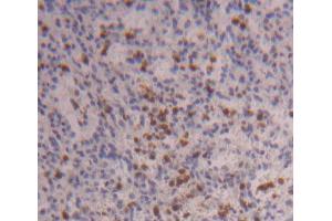 IHC-P analysis of Human Tissue, with DAB staining. (FOXO3 antibody  (AA 369-633))