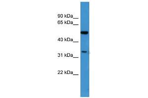 WB Suggested Anti-CERKL Antibody Titration: 0. (CERKL antibody  (N-Term))