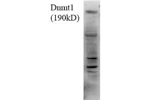 Western Blot analysis of Human H1299 cell lysate showing detection of DNMT1 protein using Mouse Anti-DNMT1 Monoclonal Antibody, Clone 4G11-C7 .