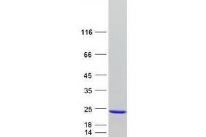 Validation with Western Blot