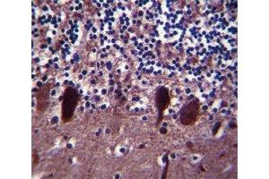 PGP 9. (UCHL1 antibody  (AA 187-214))