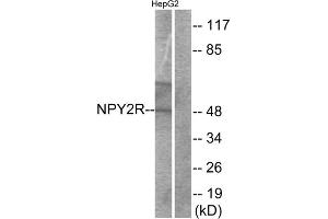 Western blot analysis of extracts from HepG2 cells, using NPY2R antibody. (NPY2R antibody  (N-Term))
