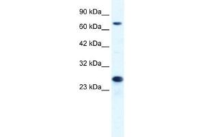 MCM6 antibody used at 1. (MCM6 antibody  (C-Term))