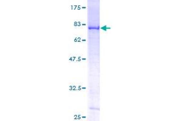 DDX6 Protein (AA 1-483) (GST tag)