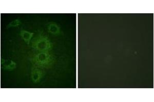 Immunofluorescence analysis of HuvEc cells, using BIK (Ab-33) Antibody.