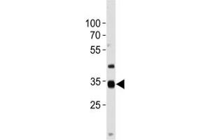 NKX3. (NKX3-2 antibody  (AA 3-2))