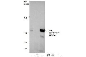 IP Image Immunoprecipitation of DNA polymerase gamma protein from MCF-7 whole cell extracts using 5 μg of DNA polymerase gamma antibody, Western blot analysis was performed using DNA polymerase gamma antibody, EasyBlot anti-Rabbit IgG  was used as a secondary reagent. (POLG antibody  (C-Term))