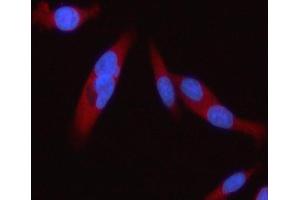 IF analysis of STAT2 using anti-STAT2 antibody (ABIN5692942). (STAT2 antibody)