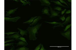 Immunofluorescence of purified MaxPab antibody to C9orf156 on HeLa cell. (C9orf156 antibody  (AA 1-441))