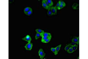 Immunofluorescent analysis of HepG2 cells using ABIN7177979 at dilution of 1:100 and Alexa Fluor 488-congugated AffiniPure Goat Anti-Rabbit IgG(H+L) (RANKL antibody  (AA 73-306))