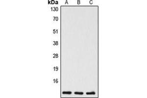 Western blot analysis of Caspase 5 p10 expression in Jurkat (A), mouse liver (B), rat liver (C) whole cell lysates. (Caspase 5 p10 antibody  (C-Term))