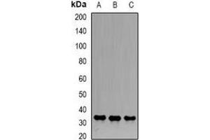 Western blot analysis of Emerin expression in Hela (A), Jurkat (B), PC3 (C) whole cell lysates. (Emerin antibody)
