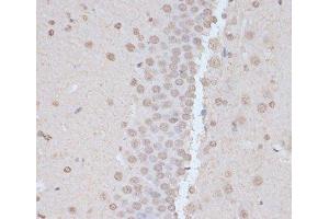 Immunohistochemistry of paraffin-embedded Rat brain using Phospho-PRKAA1(T183)/PRKAA2(T172) Polyclonal Antibody at dilution of 1:100 (40x lens). (PRKAA1 antibody  (pThr172, pThr183))