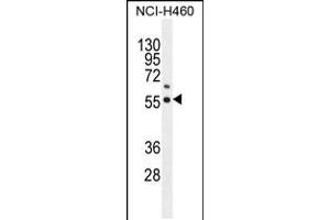 Western blot analysis in NCI-H460 cell line lysates (35ug/lane). (COQ6 antibody  (N-Term))