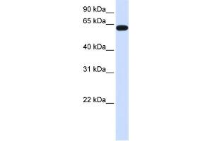 WB Suggested Anti-HS6ST3 Antibody Titration:  0.