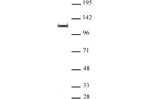 OGA/O-GlcNAcase pAb tested by Western blot. (MGEA5 antibody  (N-Term))