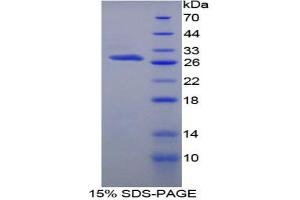 SDS-PAGE analysis of Rat Protein S Protein.