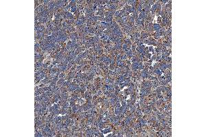 IHC analysis of SETD3 using anti-SETD3 antibody (ABIN7600293). (SETD3 antibody  (AA 173-468))