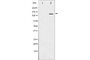 Western blot analysis of Integrin beta3 expression in NIH-3T3 whole cell lysates,The lane on the left is treated with the antigen-specific peptide.