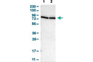 Western Blot analysis of (1) human cell line RT-4, and (2) human cell line U-251MG sp. (PTPN4 antibody  (AA 743-831))