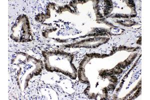 IHC analysis of Ran using anti-Ran antibody . (RAN antibody  (AA 2-216))