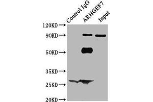 Immunoprecipitating ARHGEF7 in Hela whole cell lysate Lane 1: Rabbit control IgG (1 μg) instead of ABIN7167994 in Hela whole cell lysate. (ARHGEF7 antibody  (AA 1-250))