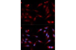 Immunofluorescence analysis of U2OS cells using ADAM9 antibody (ABIN5973121). (ADAM9 antibody)