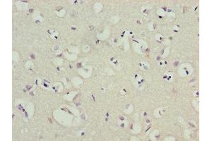 Immunohistochemistry of paraffin-embedded human brain tissue using ABIN7163973 at dilution of 1:100 (KCND1 antibody  (AA 410-647))