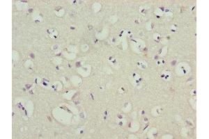 Immunohistochemistry of paraffin-embedded human brain tissue using ABIN7163973 at dilution of 1:100