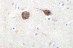 Image no. 1 for anti-C-Jun-Amino-Terminal Kinase-Interacting Protein 2 (JIP-2) antibody (ABIN272223) (IB2 antibody)