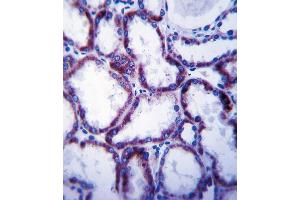 SLC22A1 Antibody (C-term) (ABIN657865 and ABIN2846821) immunohistochemistry analysis in formalin fixed and paraffin embedded human kidney tissue followed by peroxidase conjugation of the secondary antibody and DAB staining.