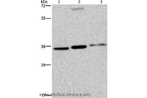 Western blot analysis of A375, 293T and SKOV3 cell, using PITX2 Polyclonal Antibody at dilution of 1:250