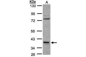 WB Image Sample(30 ug whole cell lysate) A:Raji , 10% SDS PAGE antibody diluted at 1:1000 (CCDC68 antibody)