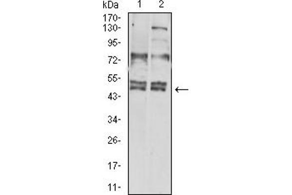 CXCR3 anticorps