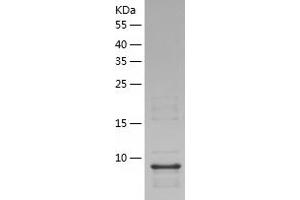 Western Blotting (WB) image for Chromosome 12 Open Reading Frame 57 (C12orf57) (AA 22-116) protein (His tag) (ABIN7285821) (C12orf57 Protein (AA 22-116) (His tag))