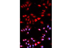 Immunofluorescence (IF) image for anti-Regulator of Calcineurin 1 (RCAN1) antibody (ABIN1876514) (RCAN1 antibody)