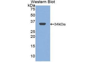 Western Blotting (WB) image for anti-Mannose Receptor, C Type 1 (MRC1) (AA 225-492) antibody (ABIN1859879) (Macrophage Mannose Receptor 1 antibody  (AA 225-492))