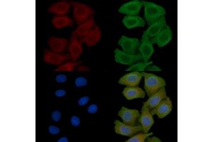 ABIN6257907 and ABIN6275041 staining Hela cells(45 min of heat-shock) by IF/ICC.