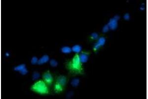 Immunofluorescence (IF) image for anti-Golgi Membrane Protein 1 (GOLM1) antibody (ABIN1498494) (GOLM1 antibody)